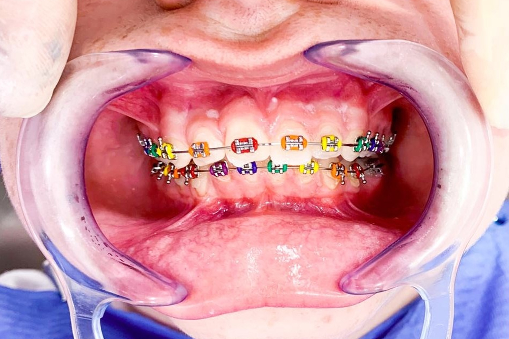 Clínica Dental Cartagena - Clínica Dental Vidal