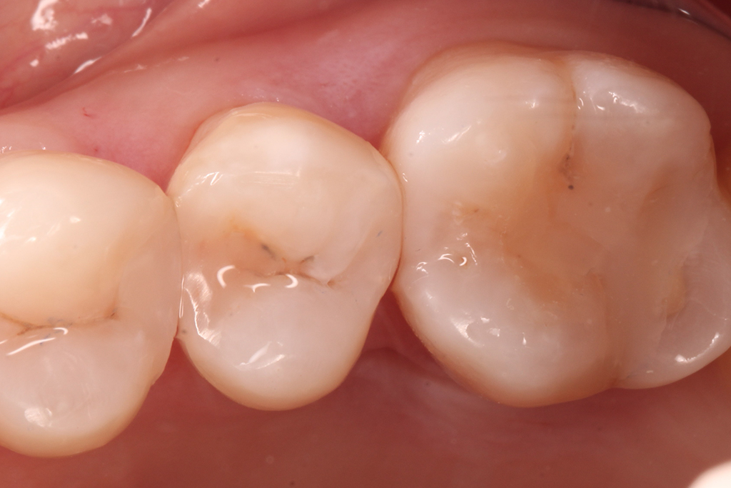 Clínica Dental Cartagena - Clínica Dental Vidal